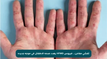 تفشي مفاجئ.. فيروس HFMD يهدد صحة الأطفال في موجة جديدة